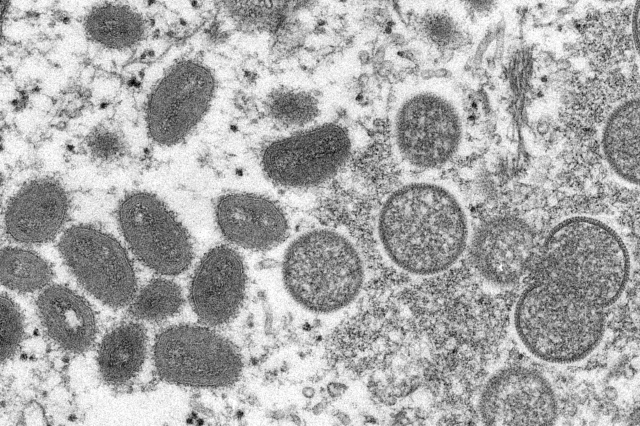 Mikroskopische Aufnahme der Affenpocken-Erreger. Foto: ČTK/AP/Uncredited