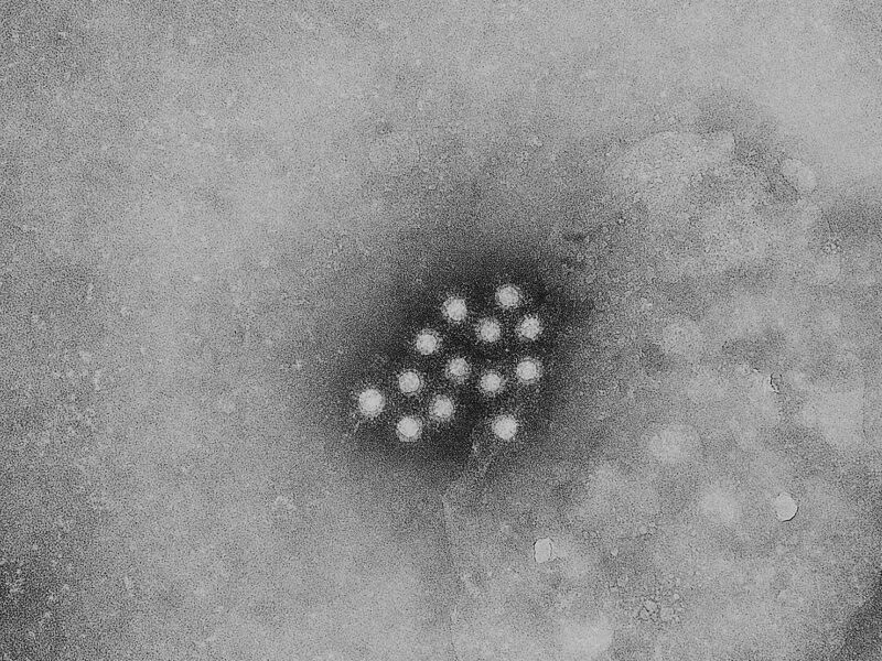 Hepatitis A breitet sich in Tschechien aus
