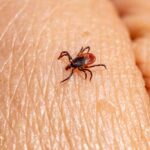 Wer in Tschechien lebt, sollte sich gegen Zeckenbisse schützen –zum Beispiel durch eine Impfung.